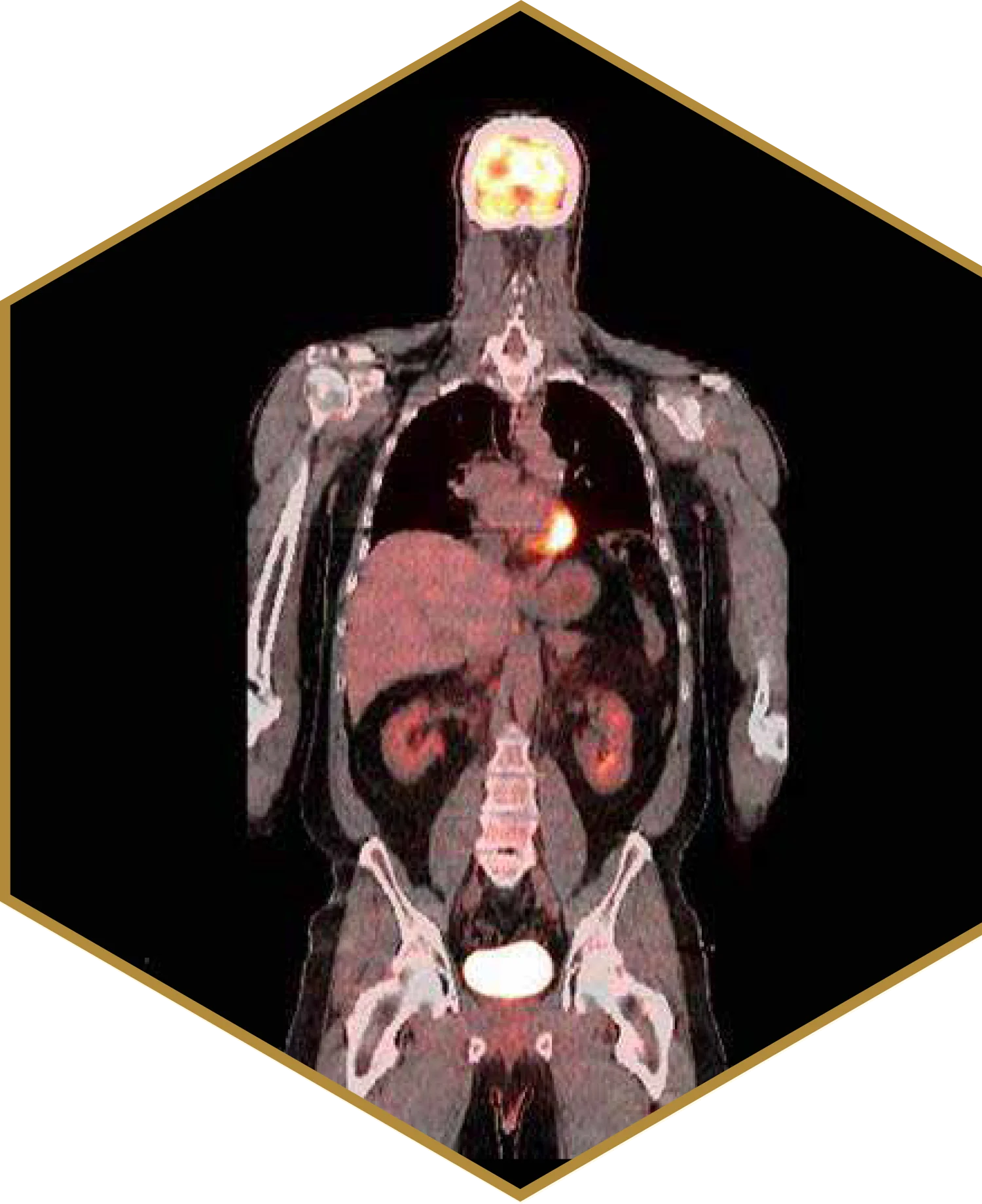 Molecular Imaging Technology Inc.